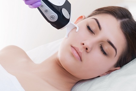 Fractional laser deals resurfacing